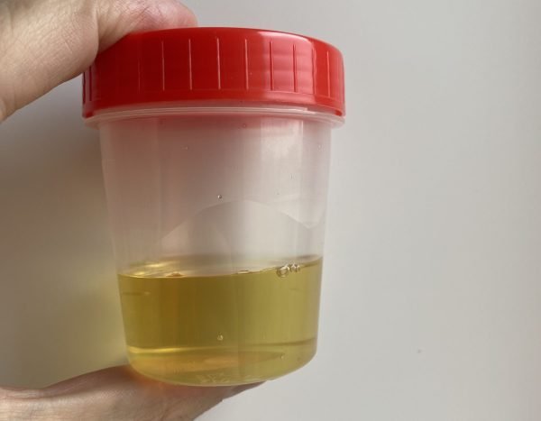 sub solution synthetic urine in a cup